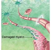 myelinh