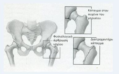 katagma isxiou