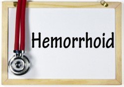 hemorrhoid sign