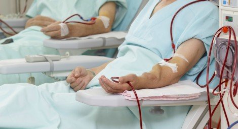 What-is-Dialys55of-Dialysis