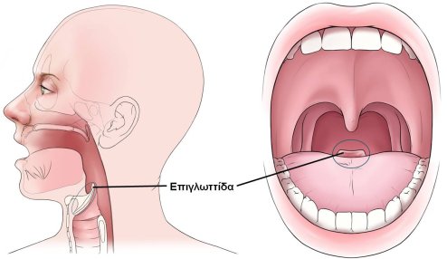 epiglottitida55