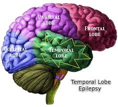 im55555temporal lobe ages