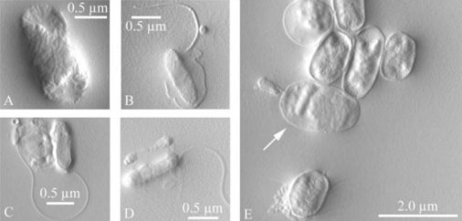 Bdellovibrio bacteriovorus