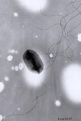 E.coli 0157