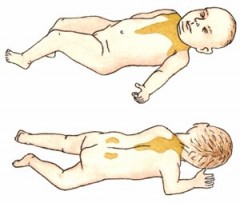 baby brown fat