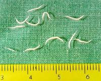 Enterobius vermicularis