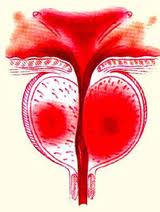 prostatitis symptomata uerapeia prostaths