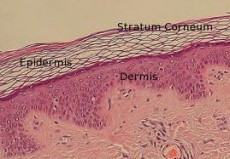 derma