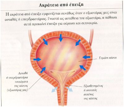 epeixh1