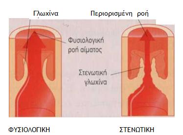 gloxina1