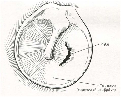 rhxh tymbanou