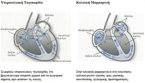 typoi arrythias1