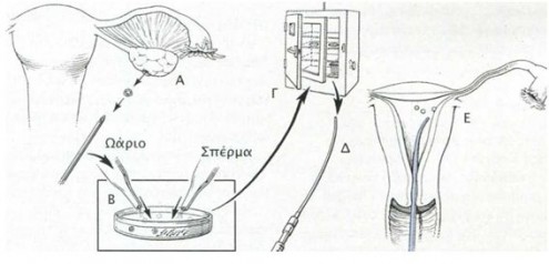 exosomatikh solhnas gonimopoihsh