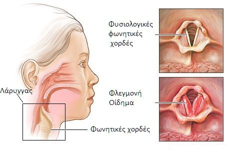 fonhtike xordes4