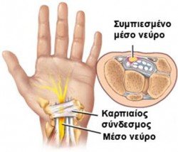 karpiaios solinas 4