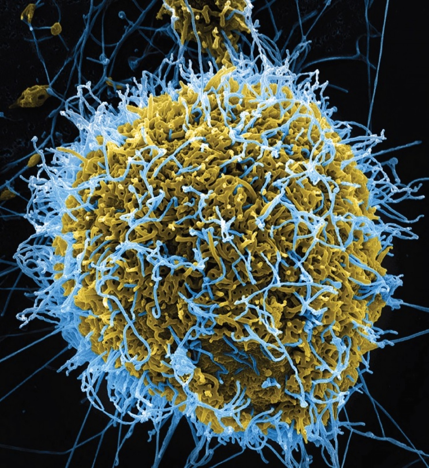 Фотографию вируса и названия. Вирус. Вирусы под микроскопом. Бактерия гриппа под микроскопом. Вирусы фото.