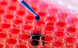 blood-test 4 karkinos