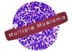 pollaplo myeloma 4