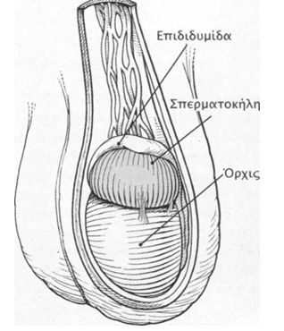 spermatokhlh