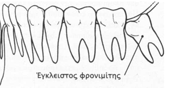 egleisa dontia5