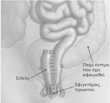 eleopprotkikh