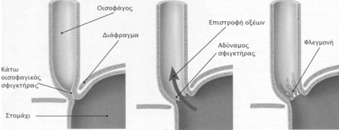 gastrooisofakikh palindromhsh 5