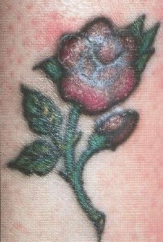 tatoo dermatopatheia