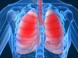cystic fibrosis 6