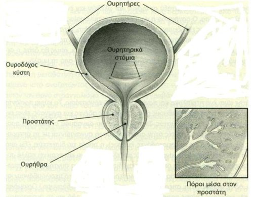 prostatis2