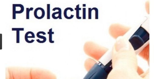 prolactin2