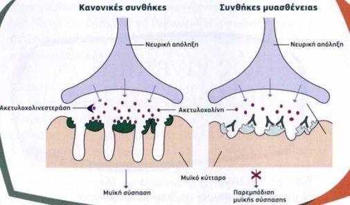 myoastheneia